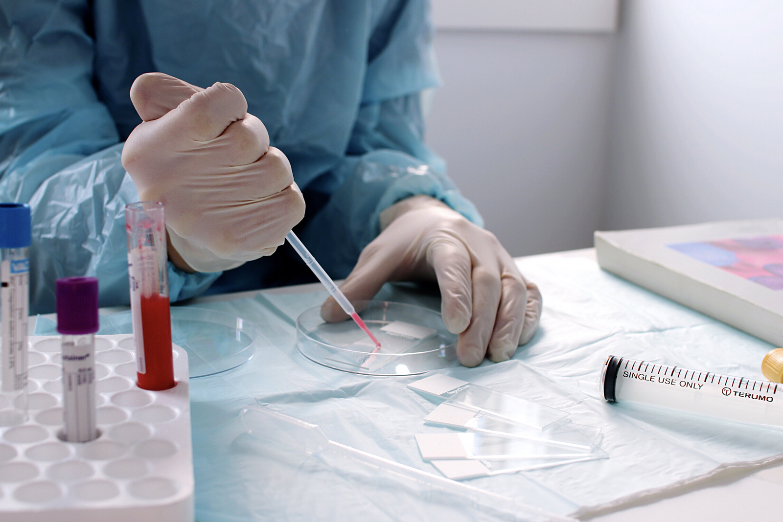 scientist holding a pipette and conducting an experiment